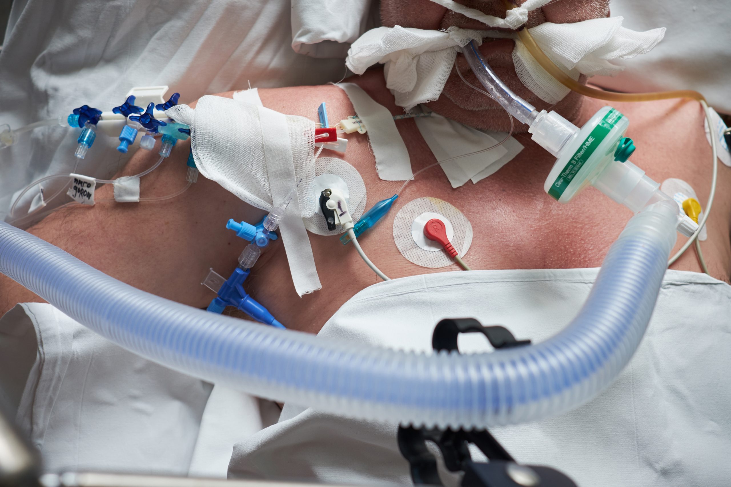 Alabama reports record COVID hospitalizations for five straight days