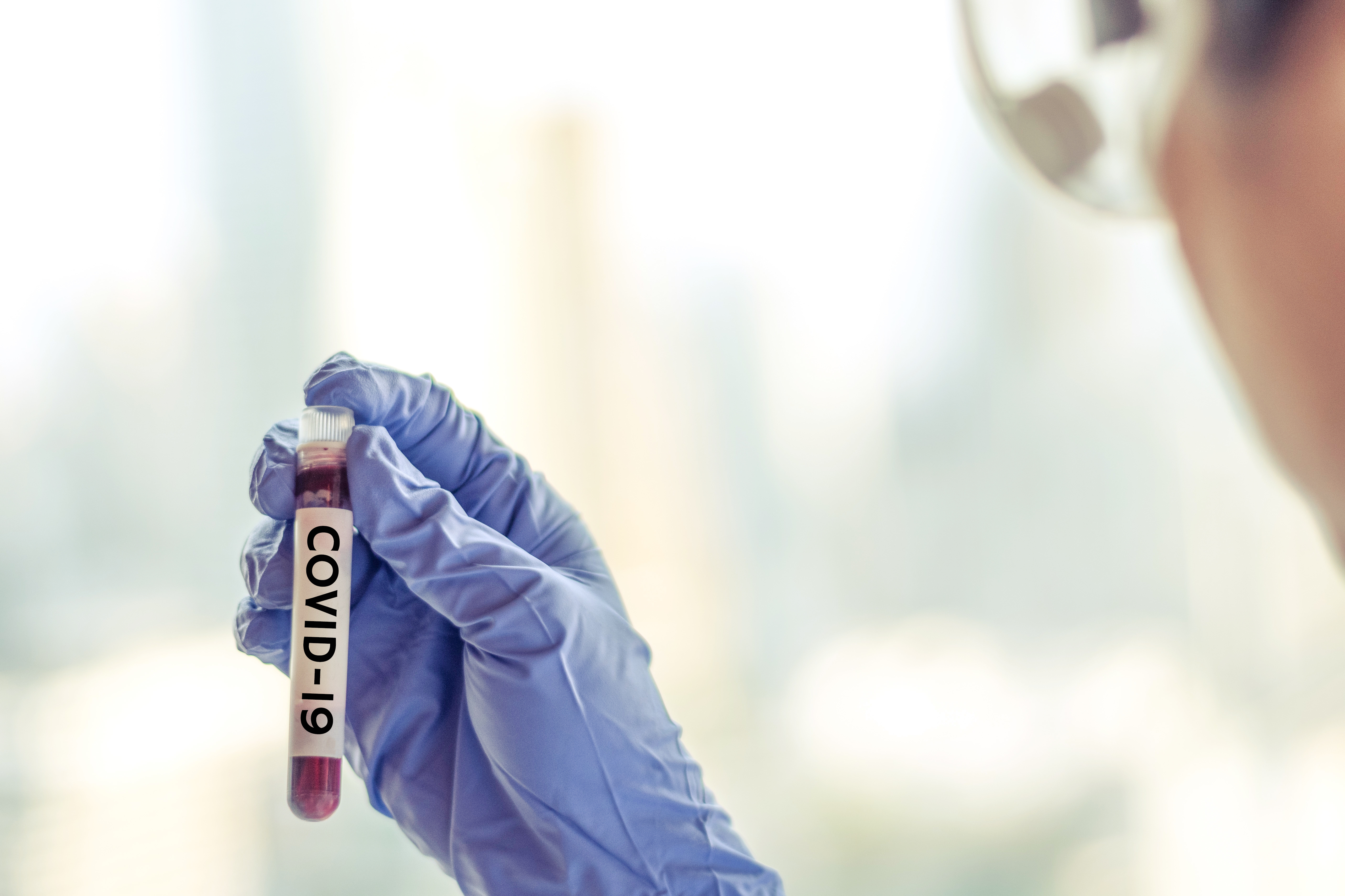 Brooks urges COVID-19 antibody tests