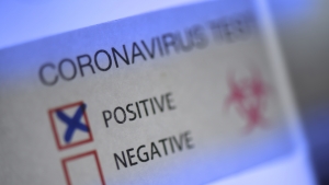 Alabama’s positivity rate reaches 42.3 percent as cases surge