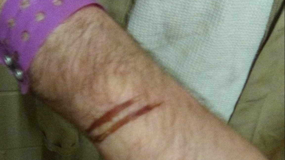 Graphic images depict alleged abuse from correctional officers