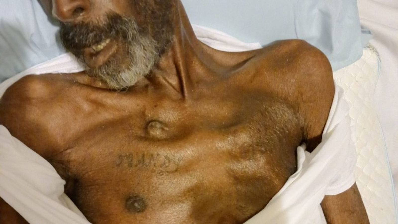 Family alleges medical neglect of man who died days after getting medical furlough