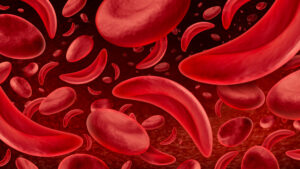 Senate unanimously advances bill aligning sickle cell commission with ADPH